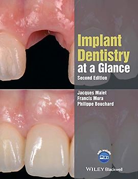 Implant Dentistry at a Glance, Second Edition