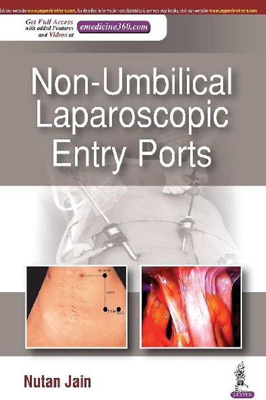 Non-Umbilical Laparoscopic Entry Ports