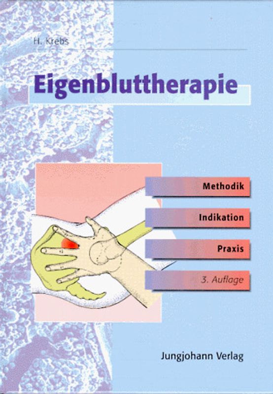Eigenbluttherapie. Methodik, Indikation und Praxis