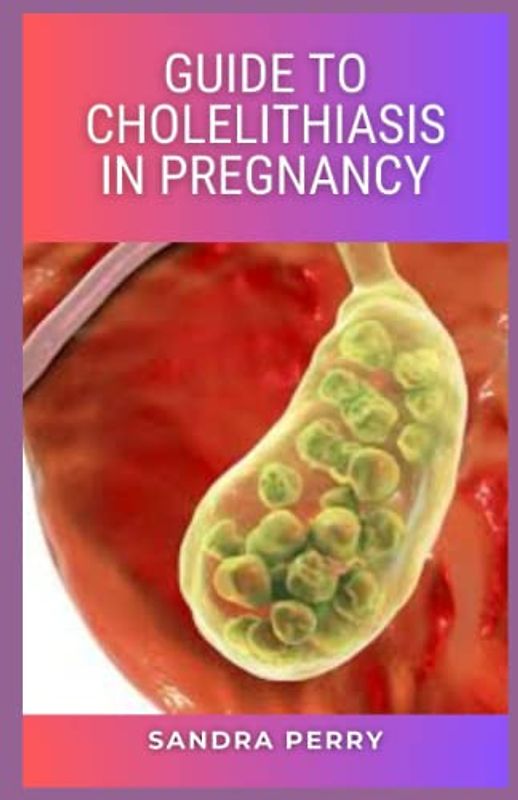 Guide to Cholelithiasis in Pregnancy: Cholelithiasis is typically not characterized by any signs or symptoms, unless there is an obstruction of the cystic duct, bile ducts, or both.