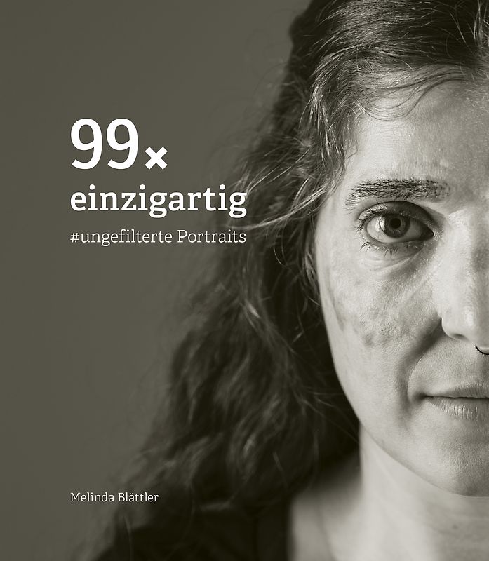 99× einzigartig