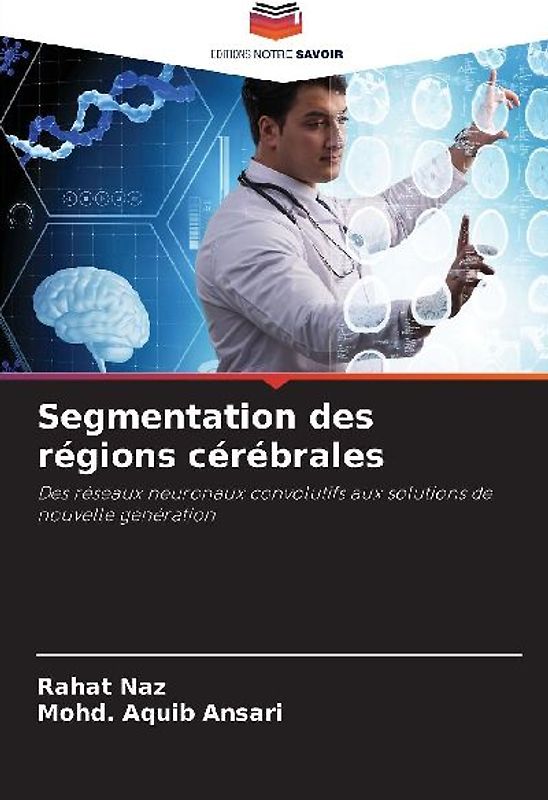 Segmentation des régions cérébrales