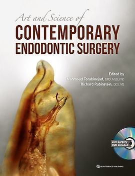 The Art and Science of Contemporary Surgical Endodontics