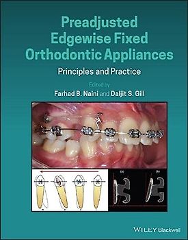 Preadjusted Edgewise Fixed Orthodontic Appliances: Principles and Practice