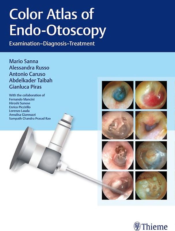 Color Atlas of Endo-Otoscopy