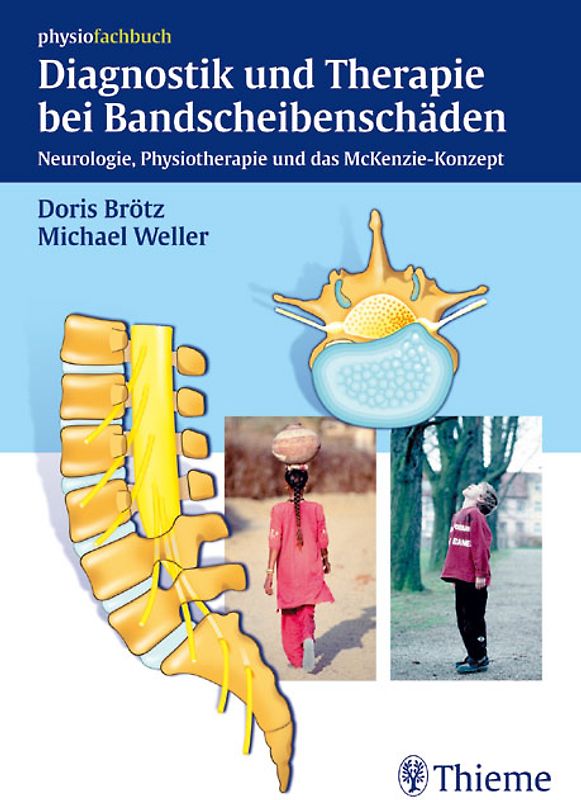 Diagnostik und Therapie bei Bandscheibenschäden