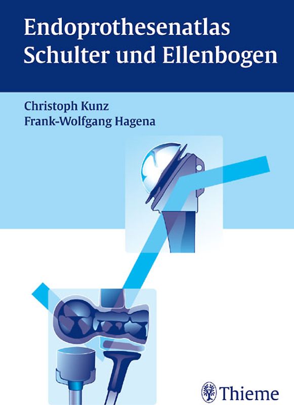 Endoprothesenatlas Schulter und Ellenbogen