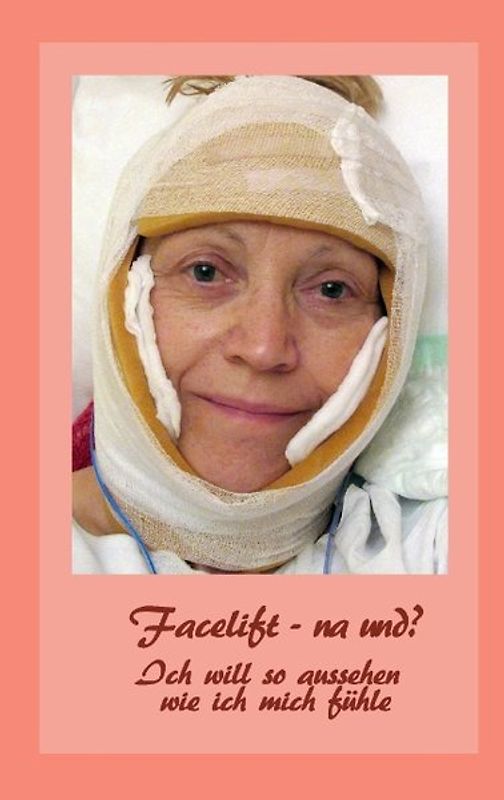 Facelift - na und?