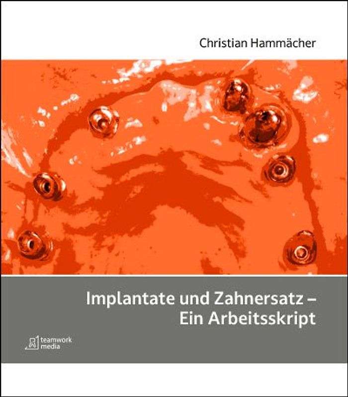 Implantate und Zahnersatz - Ein Arbeitsskript