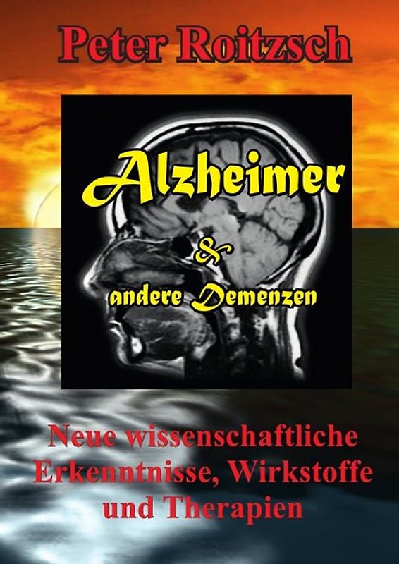 Alzheimer & andere Demenzen