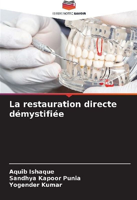 La restauration directe démystifiée