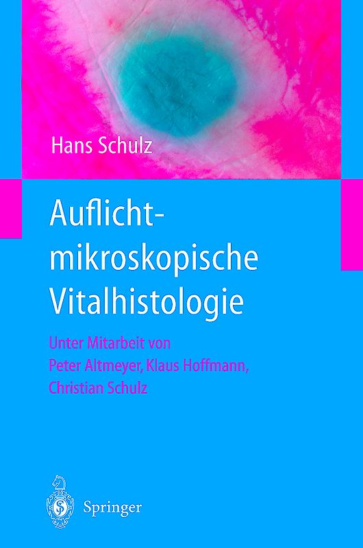 Auflichtmikroskopische Vitalhistologie