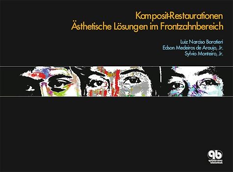 Komposit-Restaurationen an Frontzähnen