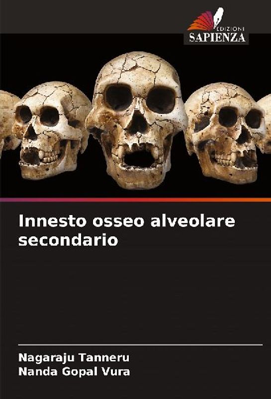 Innesto osseo alveolare secondario