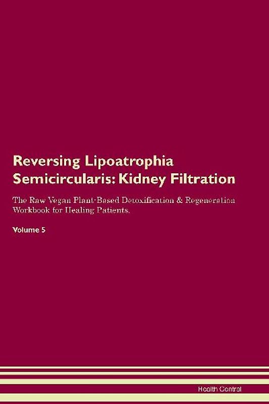 Reversing Lipoatrophia Semicircularis