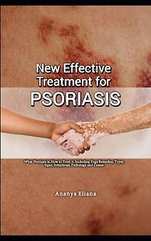 New Effective Treatment for Psoriasis: What Psoriasis is, How to Treat it, Including Yoga Remedies, Types, Signs, Symptoms, Pathology and Causes