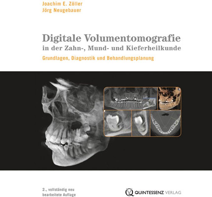 Digitale Volumentomografie in der Zahn-, Mund- und Kieferheilkunde