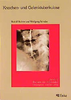 Knochen- und Gelenktuberkolose