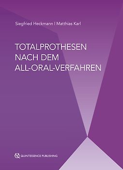 Totalprothesen nach dem All-Oral-Verfahren