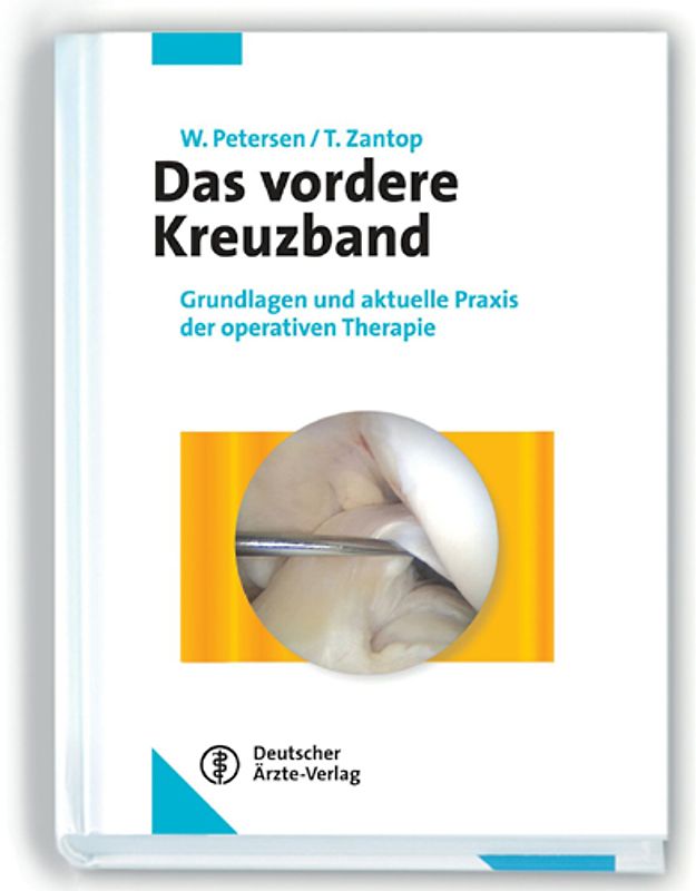 Das vordere Kreuzband