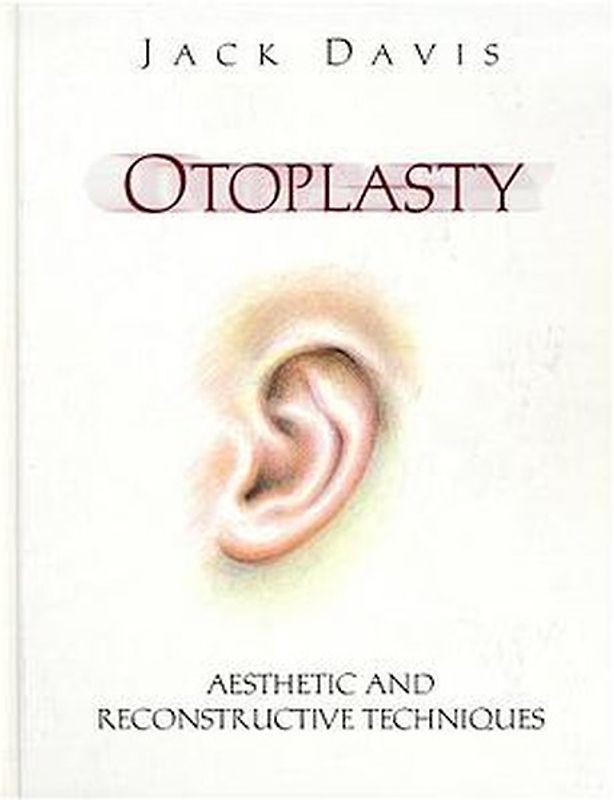 Otoplasty