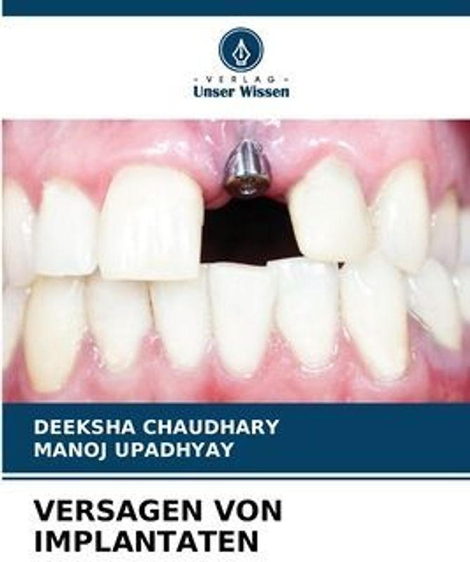 VERSAGEN VON IMPLANTATEN