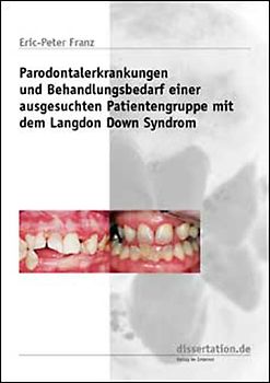 Parodontalerkrankungen und Behandlungsbedarf einer ausgesuchten Patientengruppe mit dem Langdon Down Syndrom