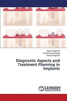 Diagnostic Aspects and Treatment Planning in Implants