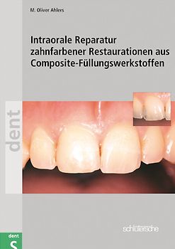 Intraorale Reparatur zahnfarbener Restaurationen aus Composite-Füllungswerkstoffen