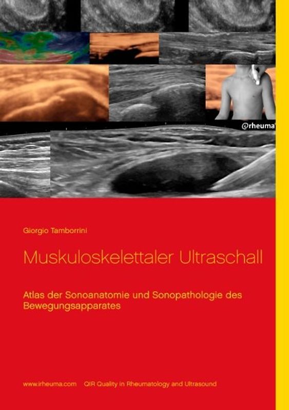 Muskuloskelettaler Ultraschall