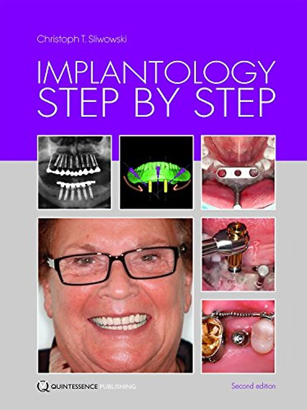 Implantology Step by Step