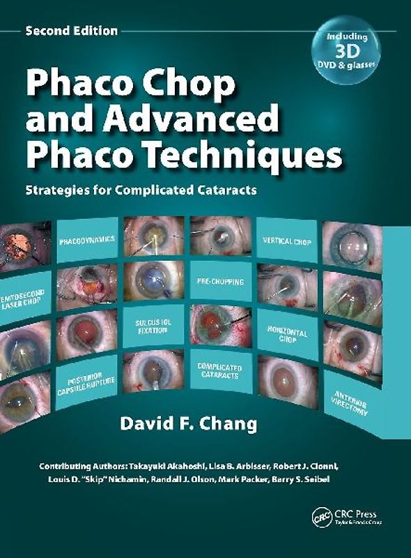 Phaco Chop and Advanced Phaco Techniques
