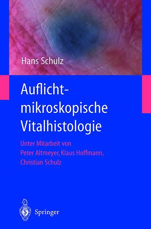 Auflichtmikroskopische Vitalhistologie. Dermatologischer Leitfaden