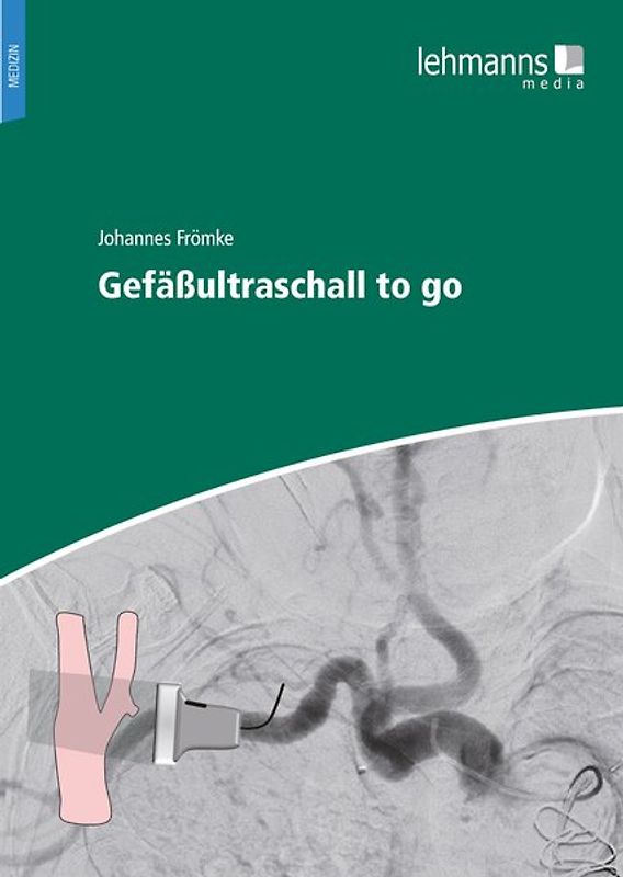 Gefäßultraschall to go