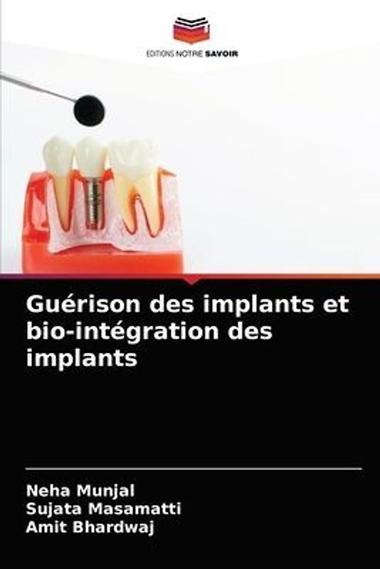 Guérison des implants et bio-intégration des implants