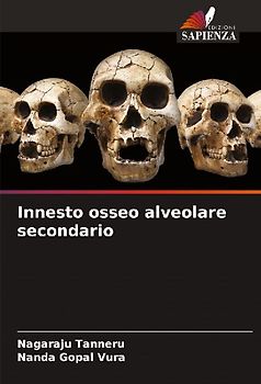 Innesto osseo alveolare secondario