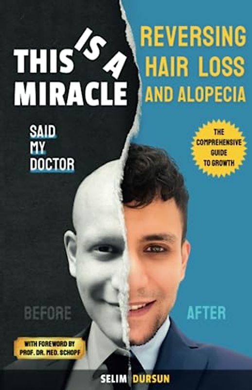 THIS IS A MIRACLE SAID MY DOCTOR: REVERSING HAIR LOSS AND ALOPECIA