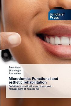Microdontia: Functional and esthetic rehabilitation