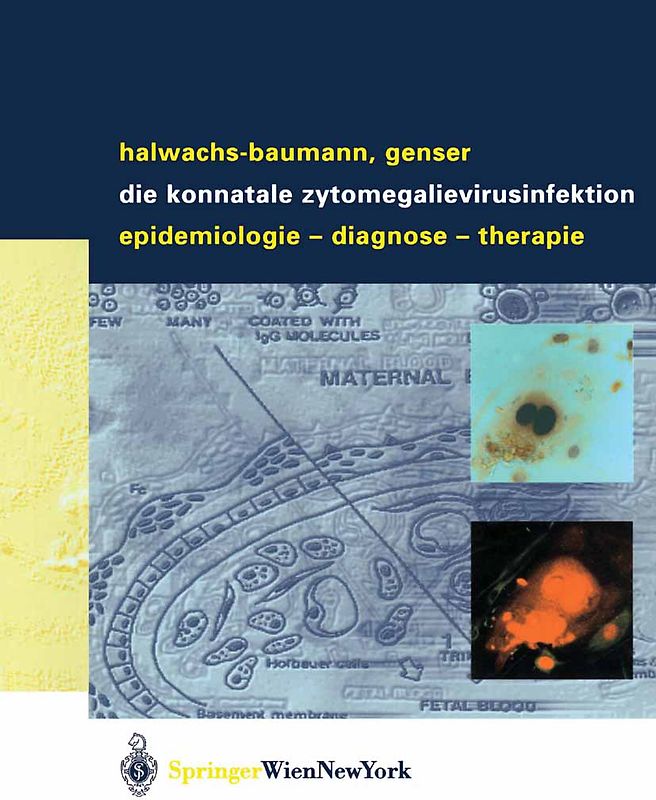 Die konnatale Zytomegalievirusinfektion