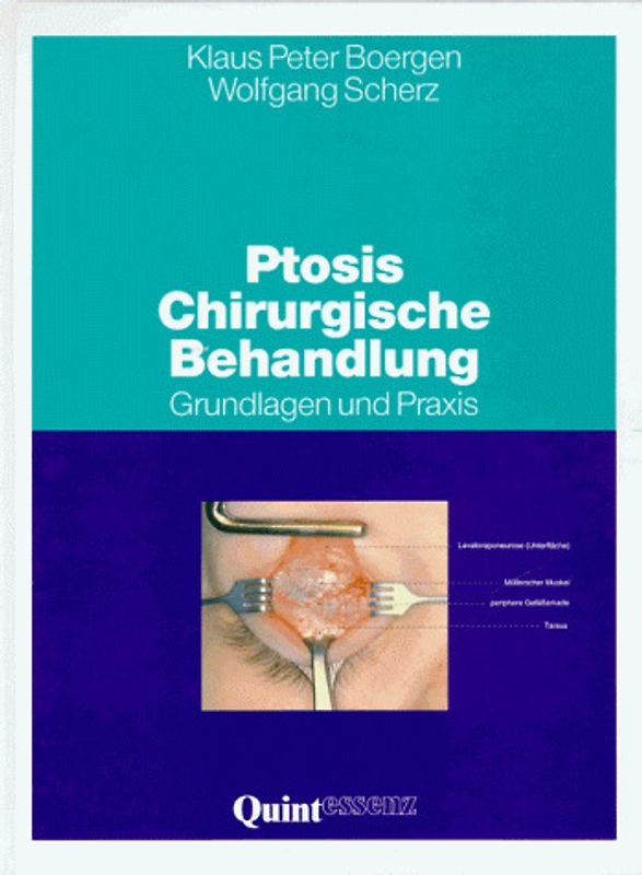 Ptosis: Chirurgische Behandlung. Grundlagen und Praxis