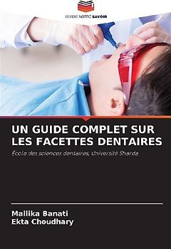 UN GUIDE COMPLET SUR LES FACETTES DENTAIRES