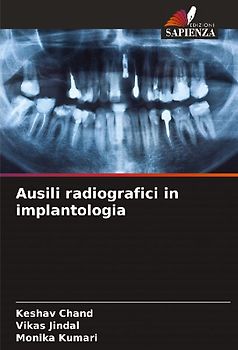 Ausili radiografici in implantologia