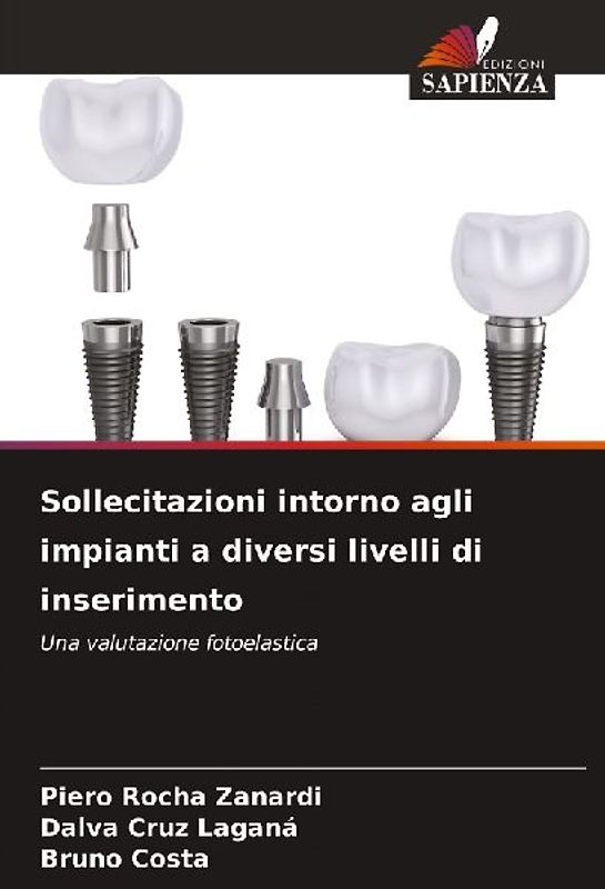 Sollecitazioni intorno agli impianti a diversi livelli di inserimento