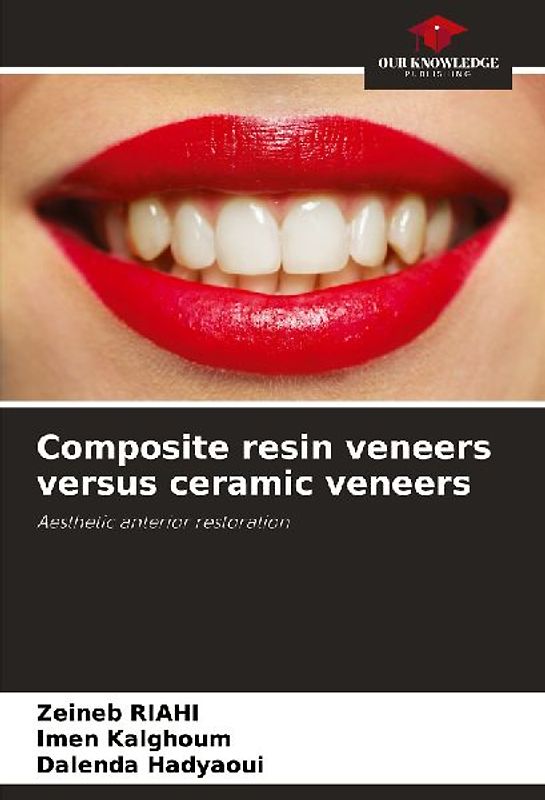 Composite resin veneers versus ceramic veneers