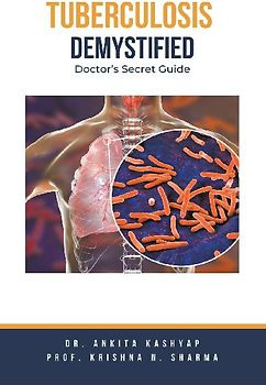 Tuberculosis Demystified