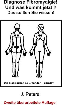 Diagnose Fibromyalgie! Und was kommt jetzt?