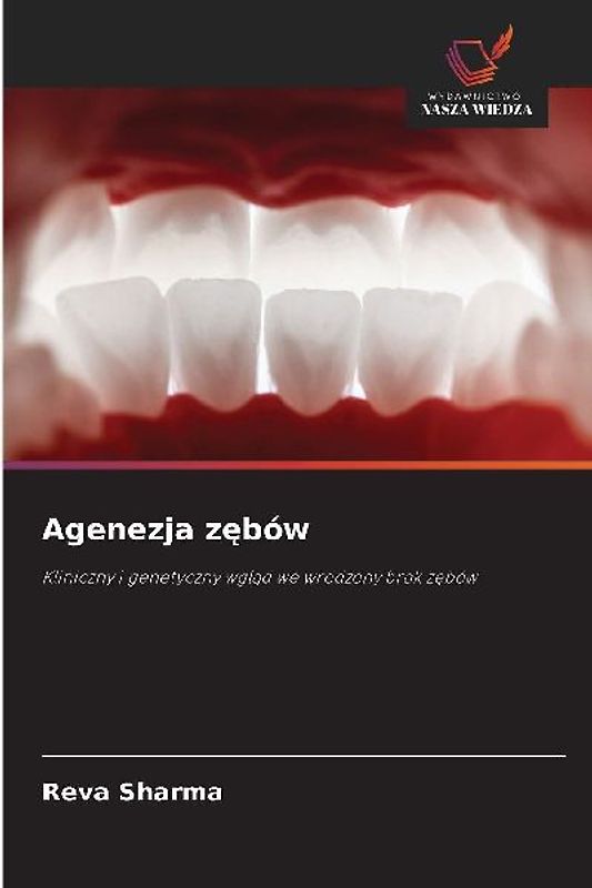 Agenezja zębów