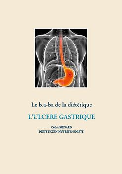 Le b.a-ba de la diététique pour l'ulcère gastrique