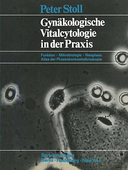 Gynäkologische Vitalcytologie in der Praxis