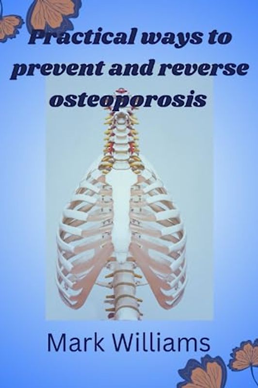 Practical ways to prevent and reverse osteoporosis: Osteoporosis prevention guide, diet book, Safe and Effective Exercise for osteoporosis